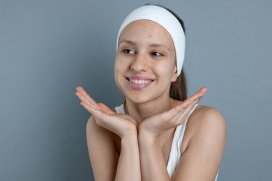 Photo of Teenage girl with acne problem on grey background