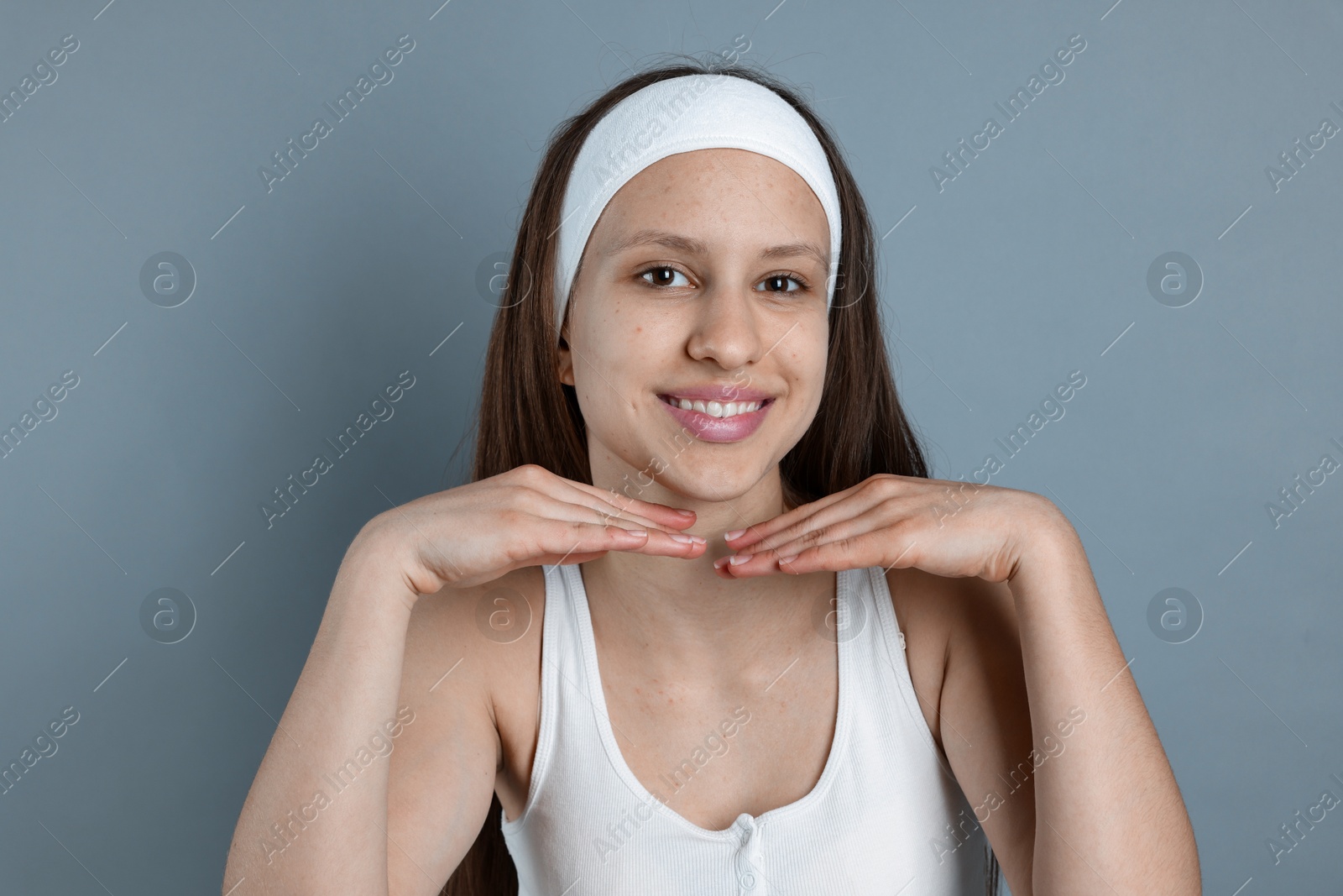 Photo of Teenage girl with acne problem on grey background