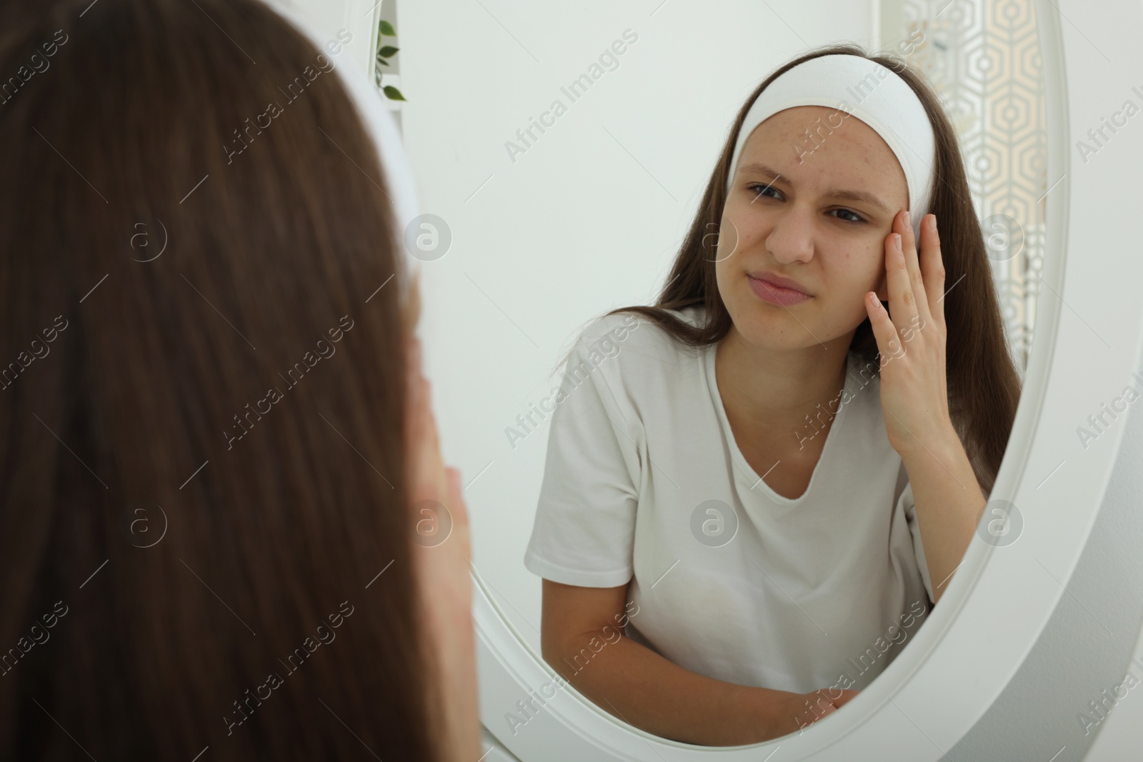 Photo of Upset teenage girl with acne problem looking in mirror indoors