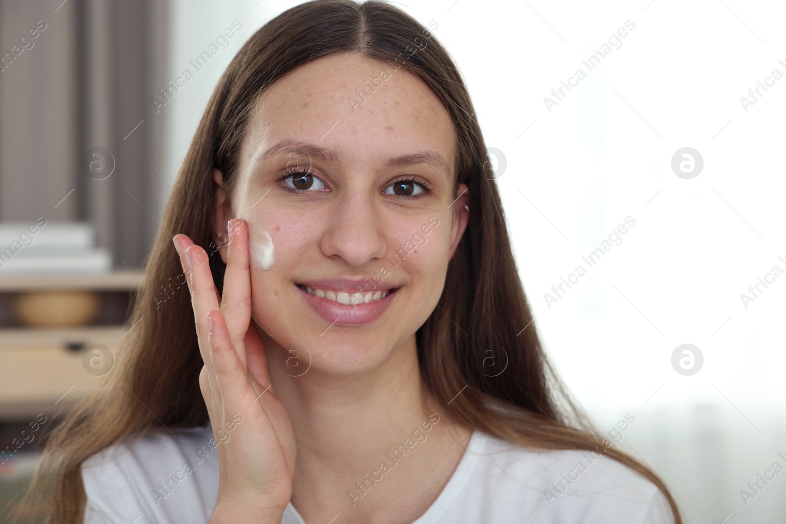 Photo of Teenage girl applying cream onto face at home. Acne treatment