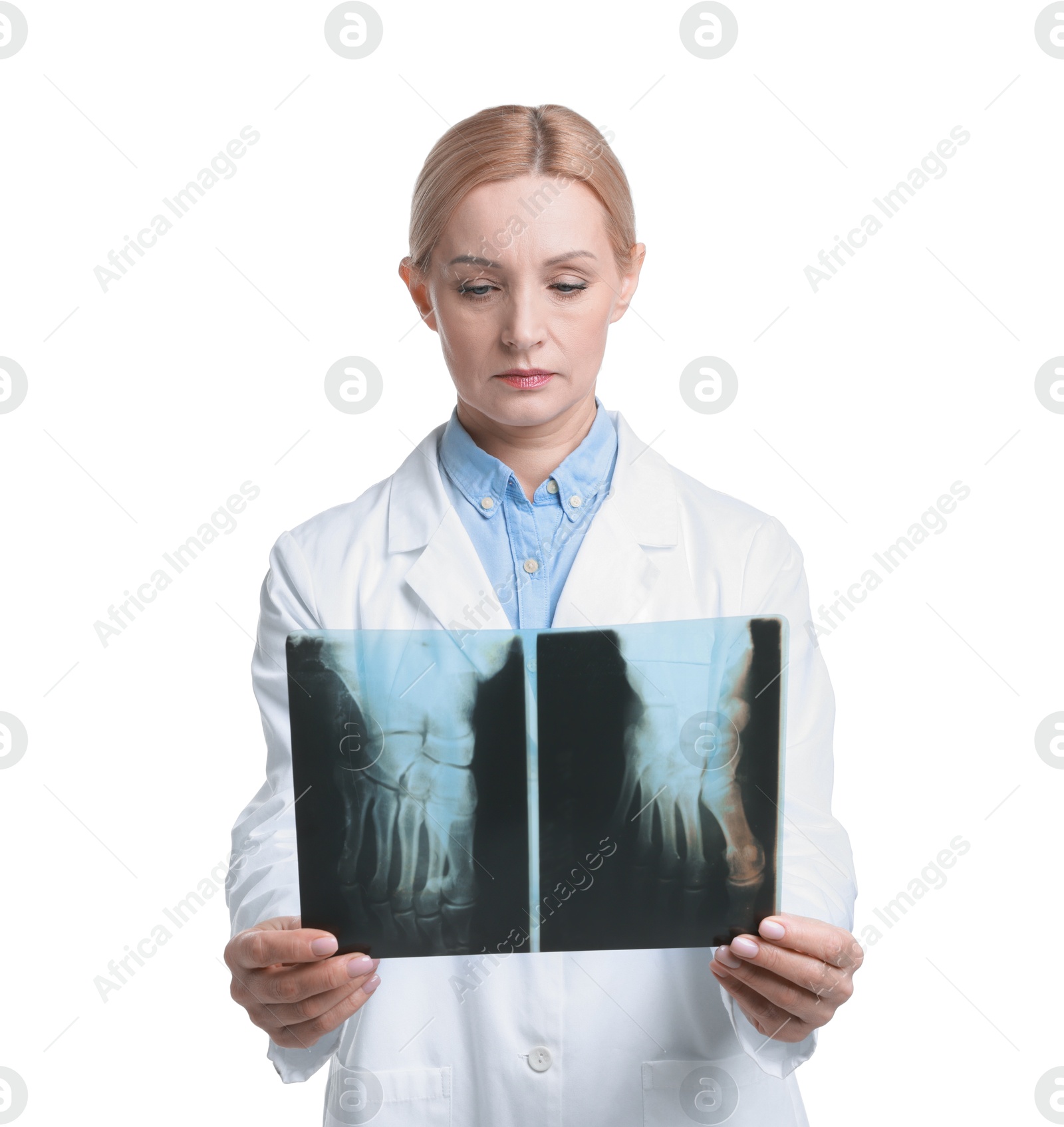 Photo of Doctor examining foot x-ray on white background