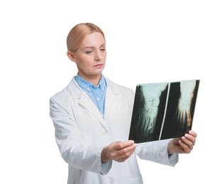 Photo of Doctor examining foot x-ray on white background