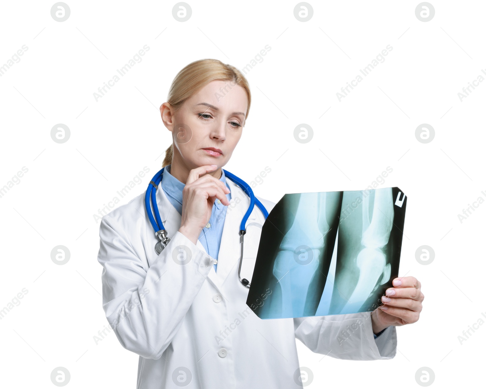 Photo of Doctor examining x-ray image of knee joint on white background