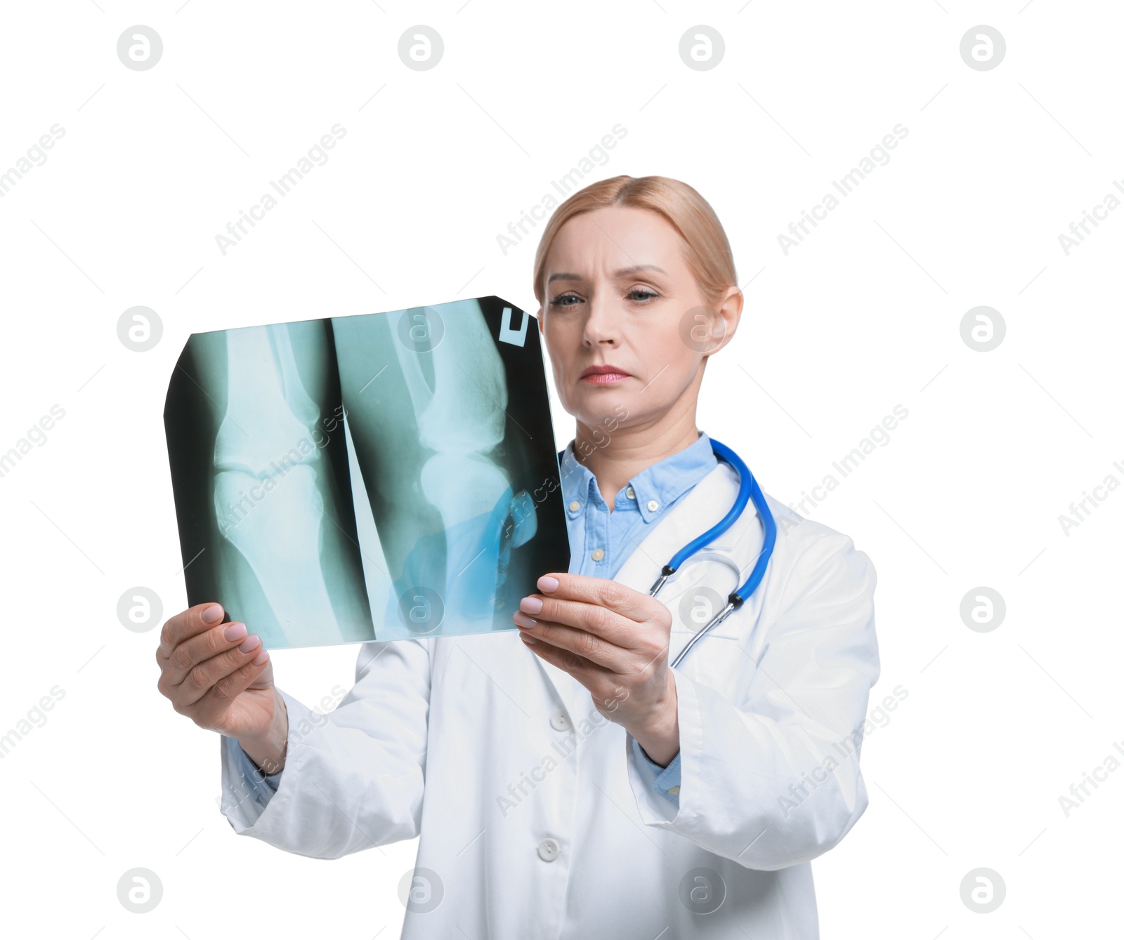 Photo of Doctor examining x-ray image of knee joint on white background