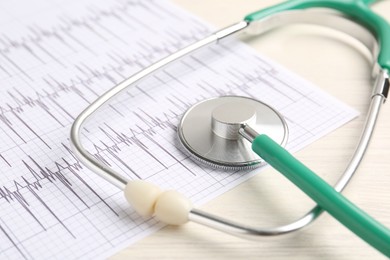 Photo of Cardiology. Stethoscope and cardiogram on light table, closeup