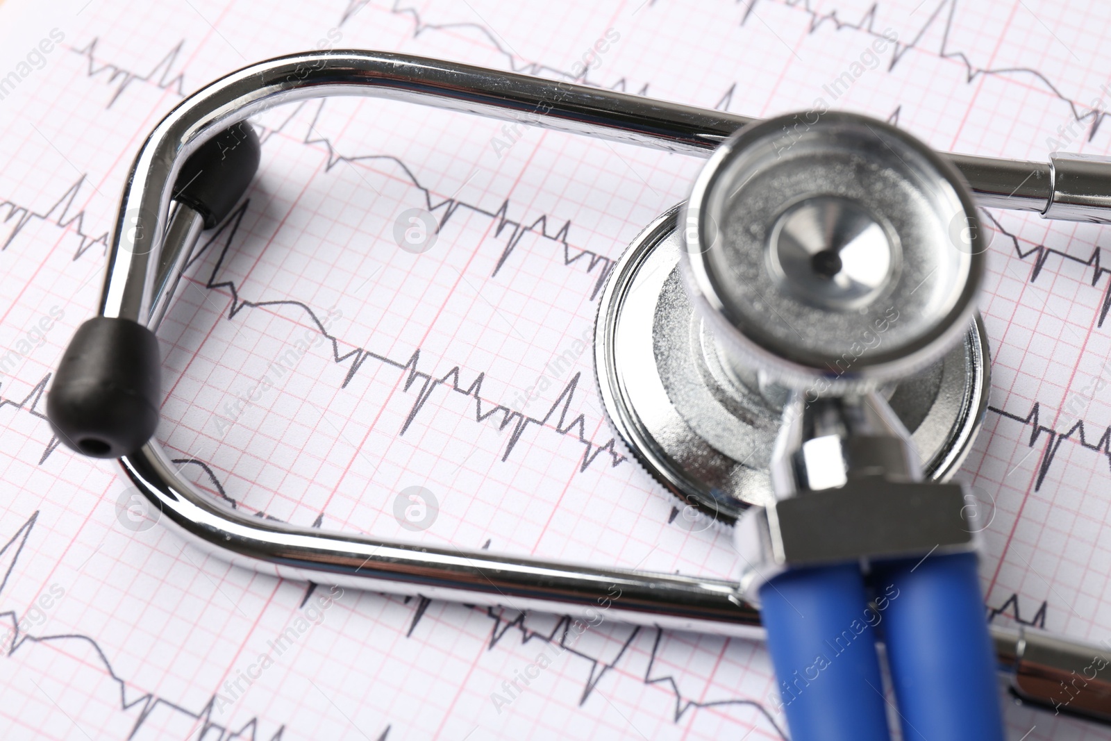 Photo of Cardiology. Stethoscope on paper with cardiogram, closeup