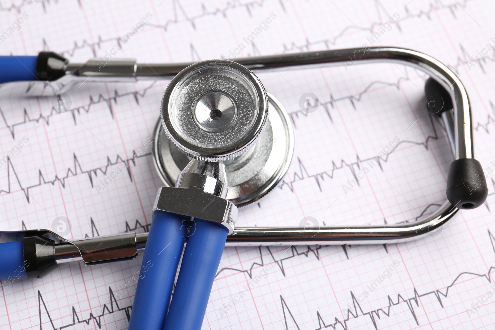 Photo of Cardiology. Stethoscope on paper with cardiogram, closeup