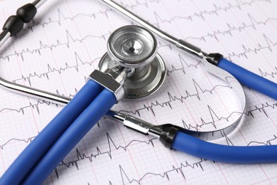 Photo of Cardiology. Stethoscope on paper with cardiogram, closeup