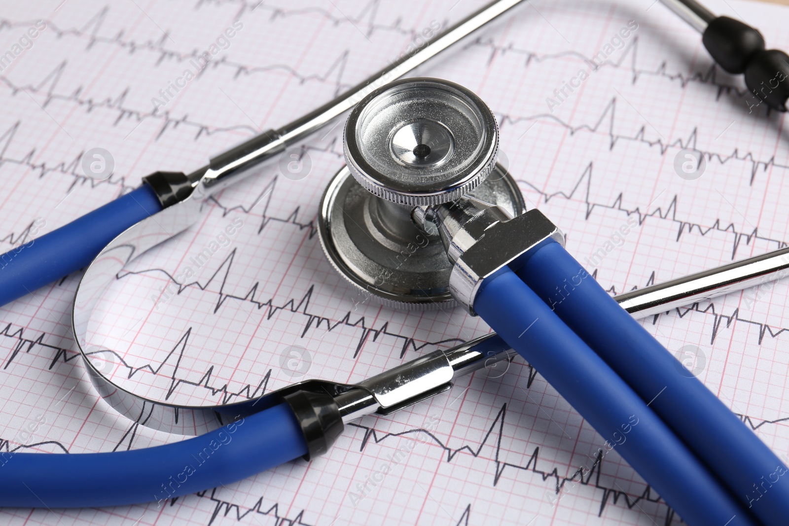 Photo of Cardiology. Stethoscope on paper with cardiogram, closeup