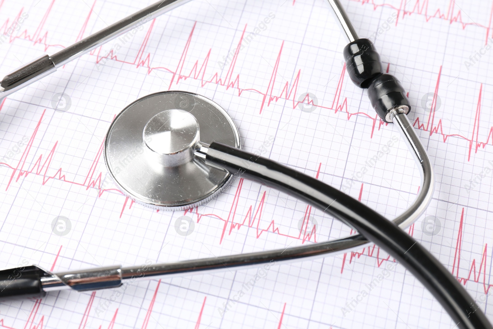 Photo of Cardiology. Stethoscope on paper with cardiogram, closeup