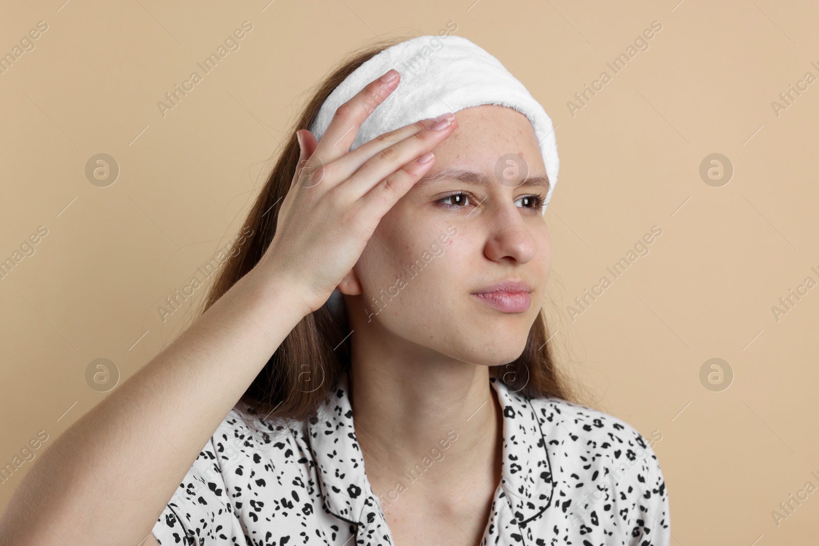 Photo of Teenage girl touching pimple on her face against beige background. Acne problem