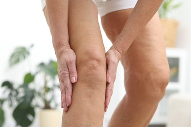 Photo of Woman suffering from pain in her knee at home, closeup