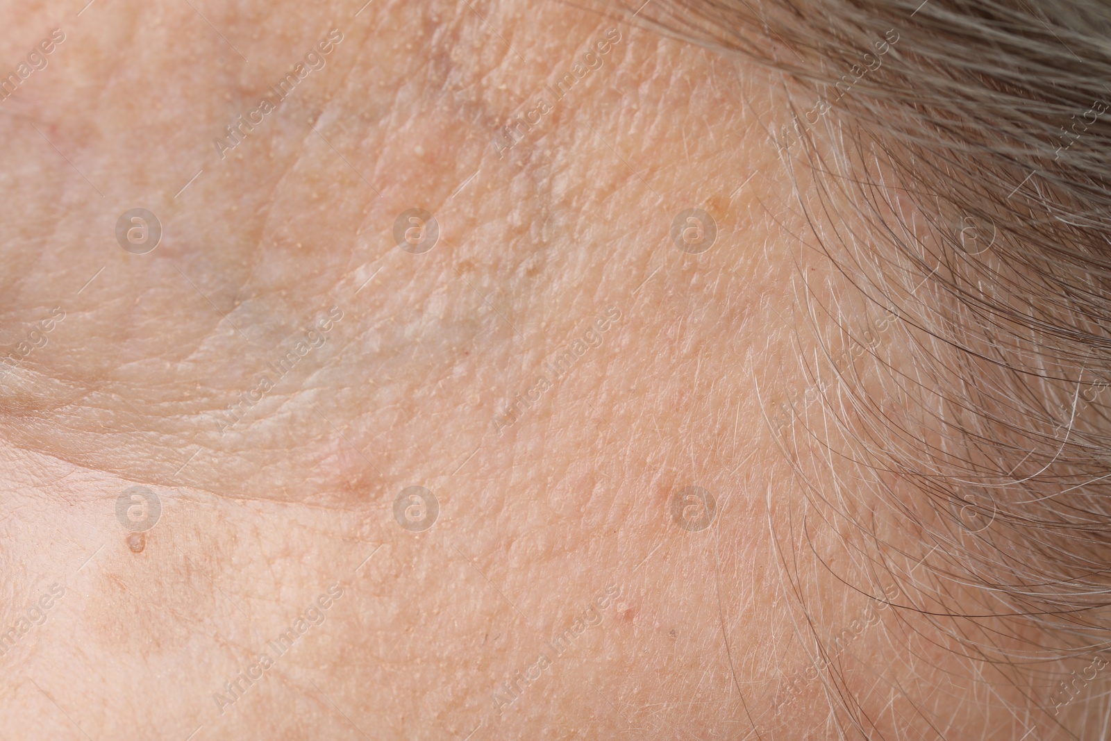 Photo of Macro view of dry skin as background