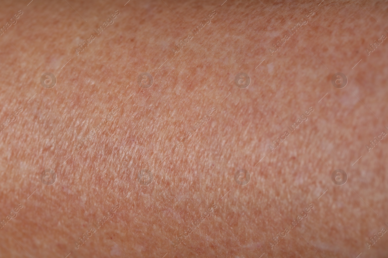 Photo of Macro view of dry skin as background