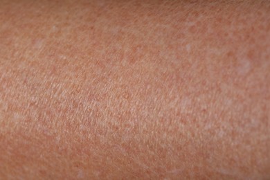 Photo of Macro view of dry skin as background