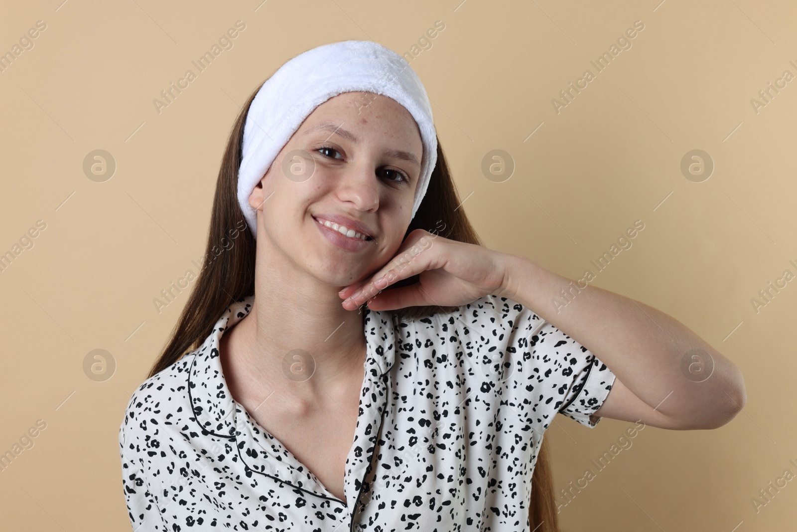 Photo of Teenage girl with acne problem on beige background