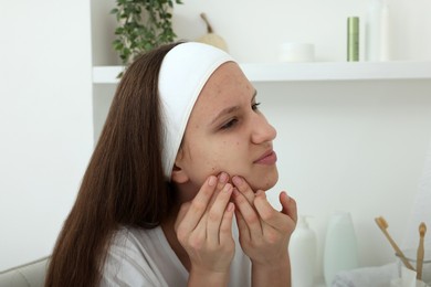 Photo of Upset teenage girl popping pimple on her face indoors. Acne problem