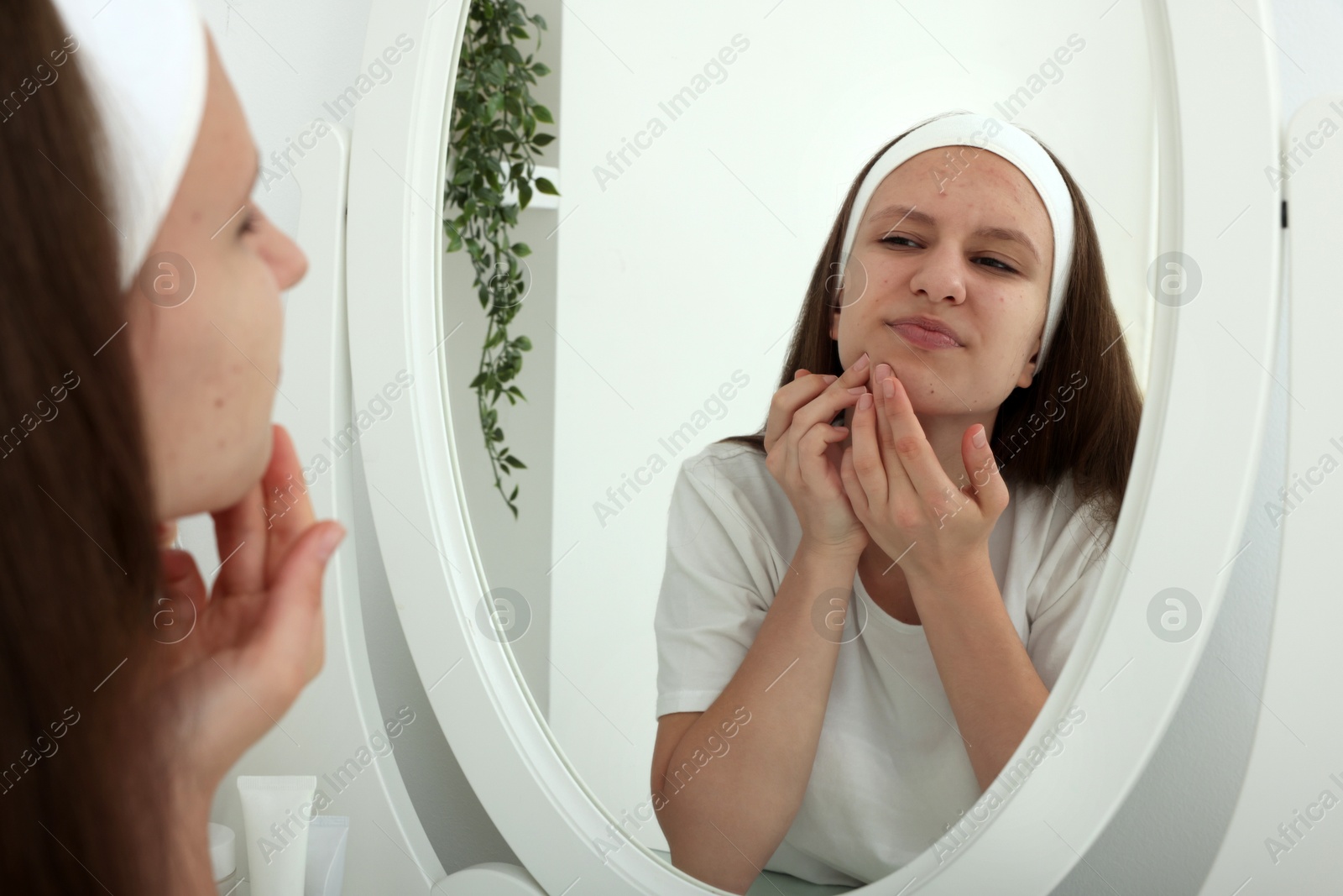 Photo of Upset teenage girl popping pimple on her face near mirror indoors. Acne problem