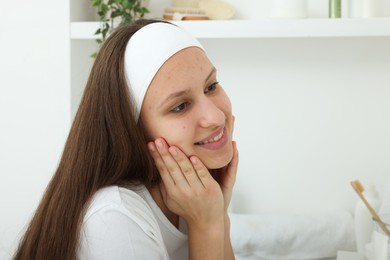 Photo of Teenage girl with acne problem at home. Space for text