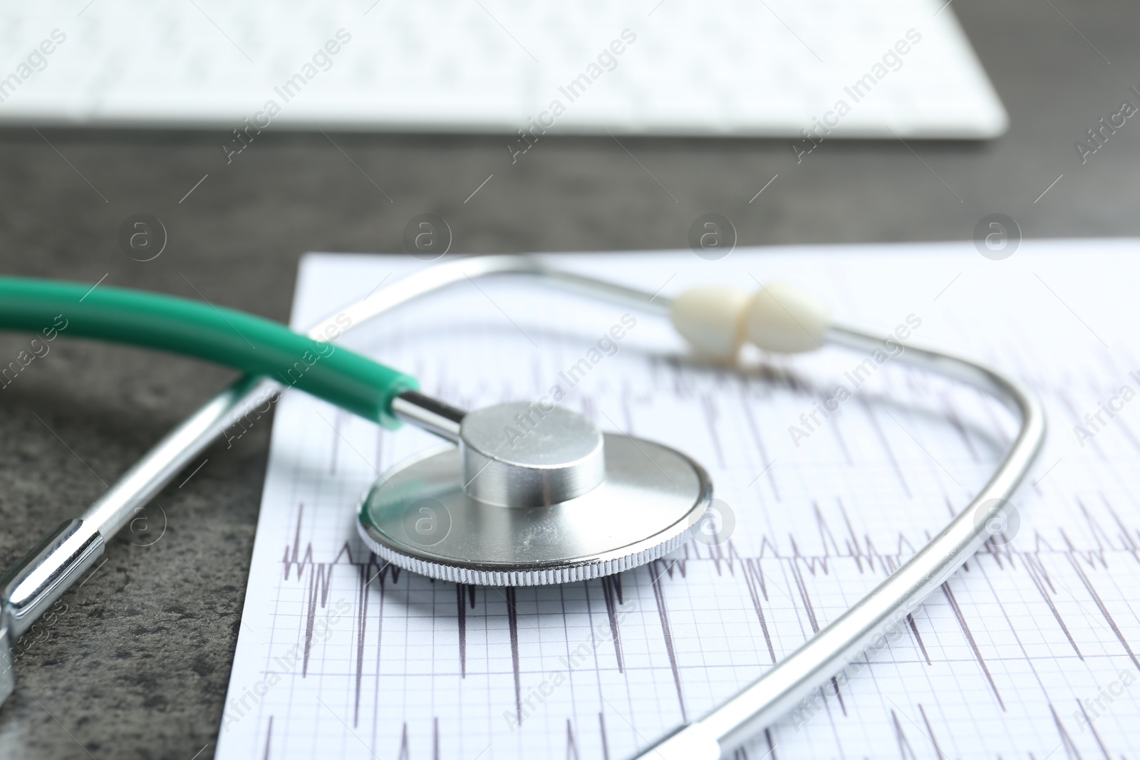 Photo of Cardiology. Cardiogram and stethoscope on gray textured table, closeup