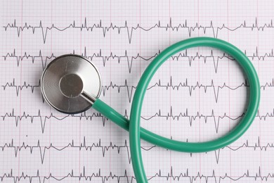 Photo of Cardiology. Stethoscope on paper with cardiogram, top view