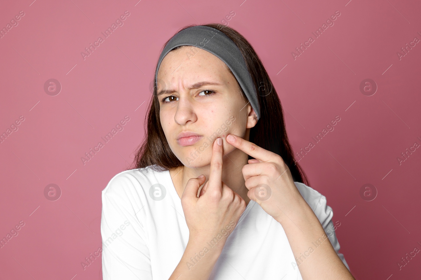 Photo of Upset teenage girl popping pimple on her face against pink background. Acne problem