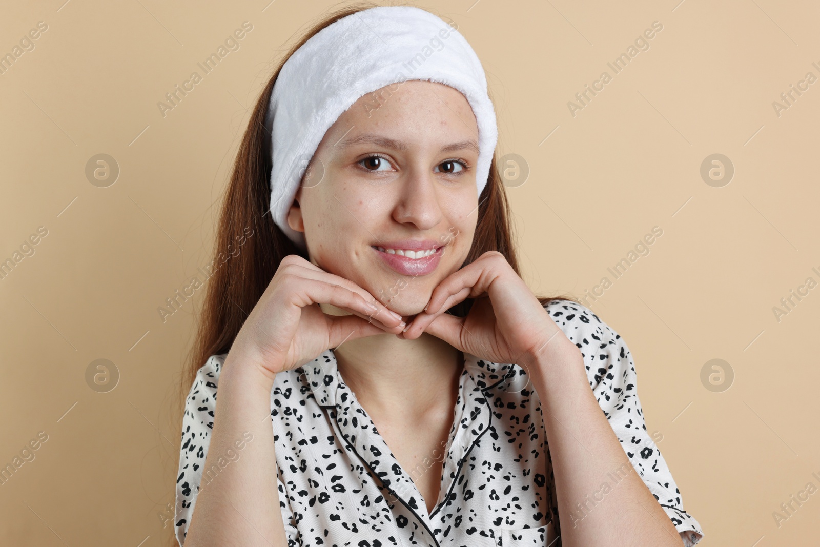 Photo of Teenage girl with acne problem on beige background