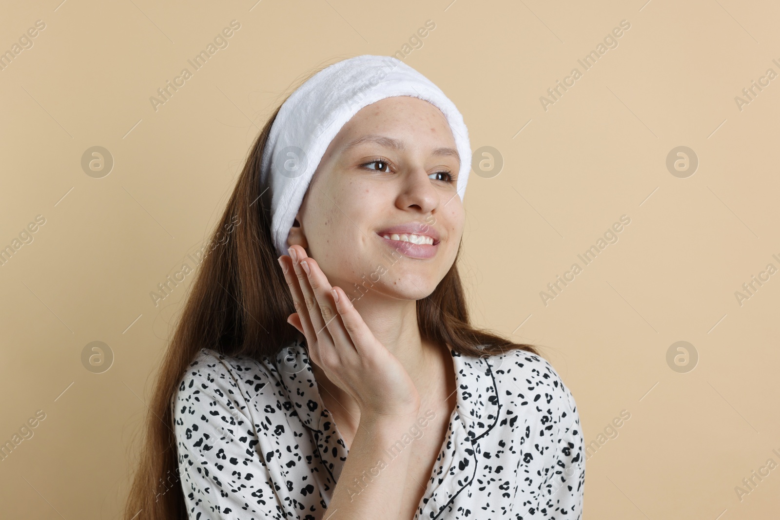 Photo of Teenage girl with acne problem on beige background