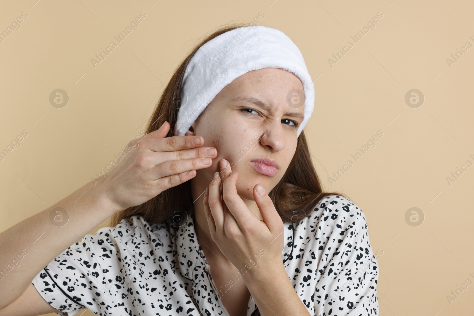 Photo of Upset teenage girl popping pimple on her face against beige background. Acne problem