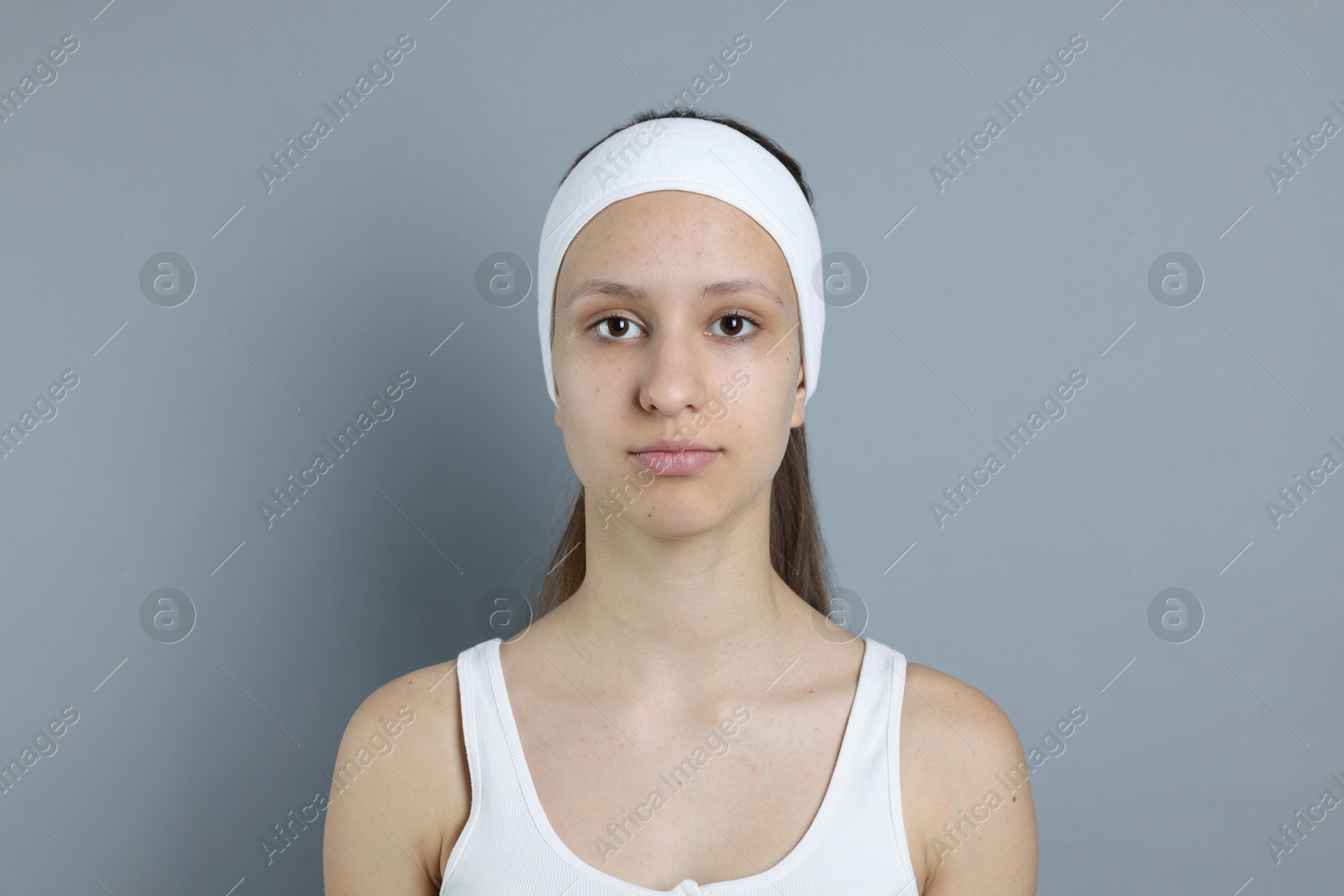 Photo of Teenage girl with acne problem on grey background