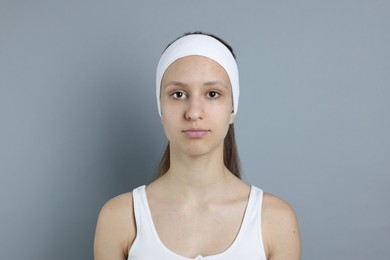 Photo of Teenage girl with acne problem on grey background