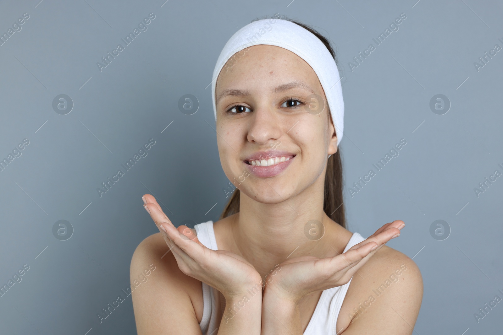 Photo of Teenage girl with acne problem on grey background