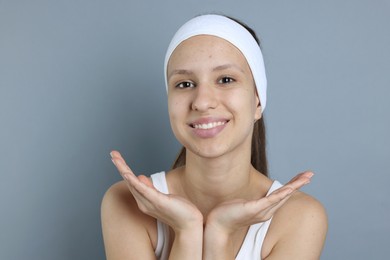 Teenage girl with acne problem on grey background