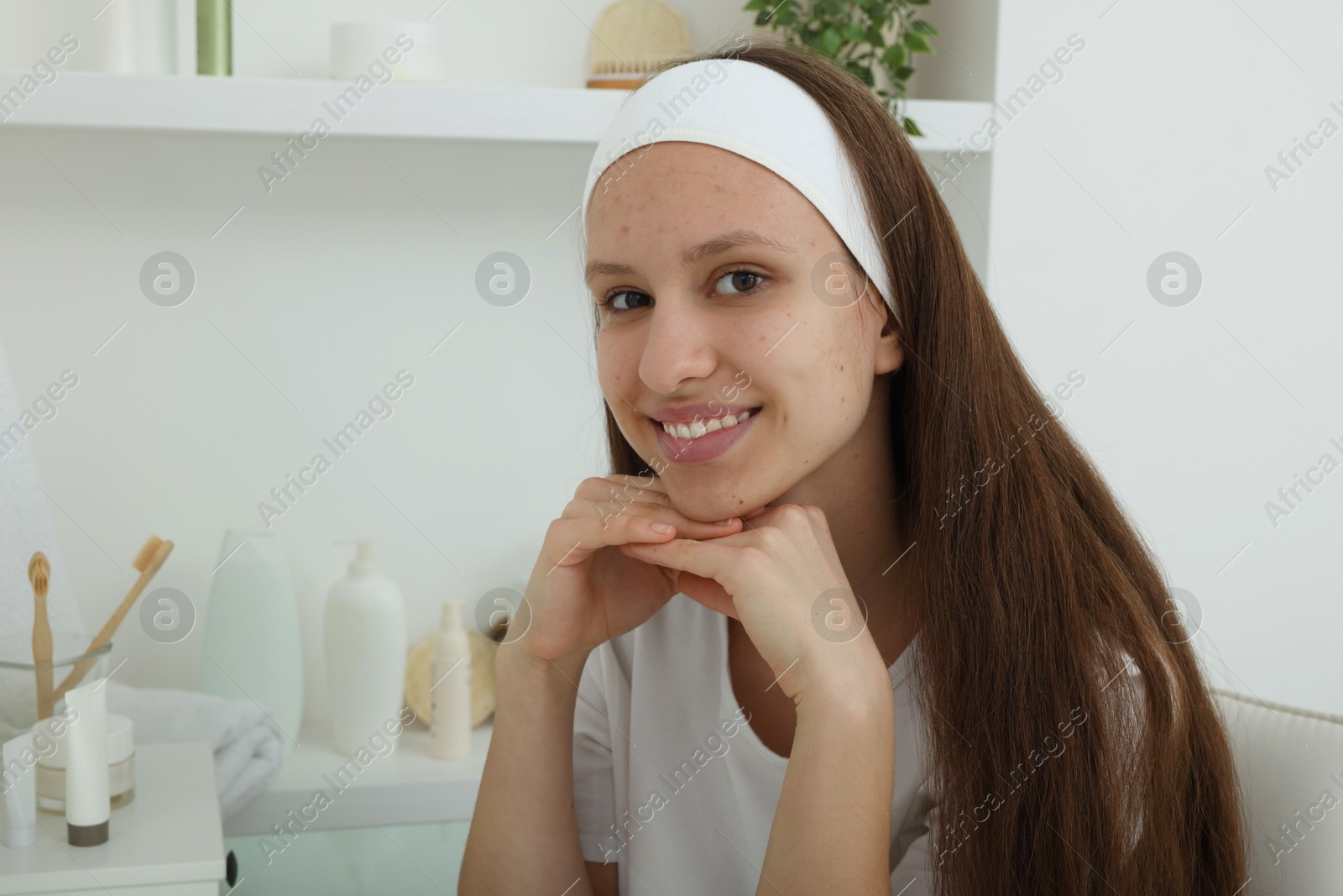 Photo of Portrait of teenage girl with acne problem indoors