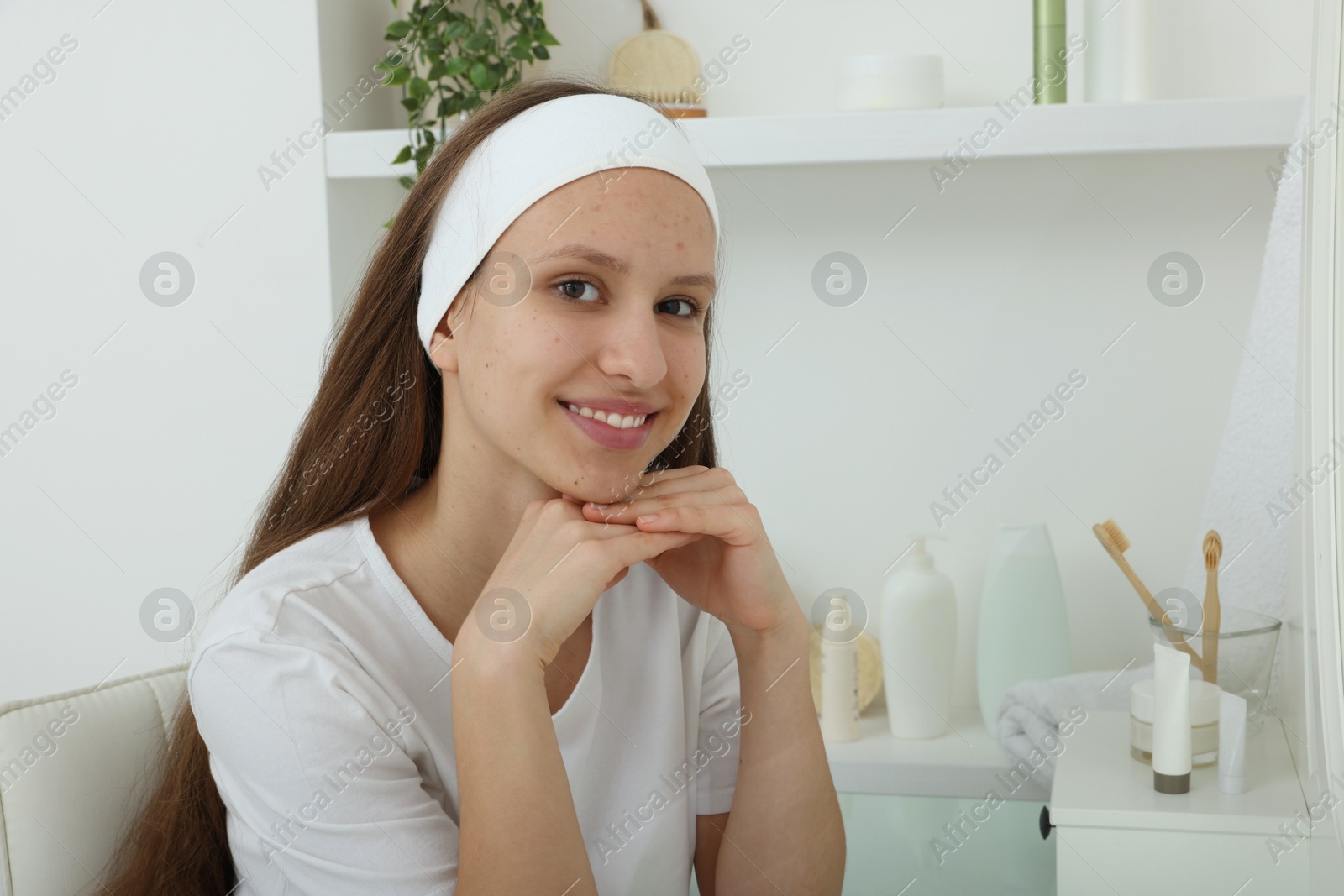 Photo of Portrait of teenage girl with acne problem indoors