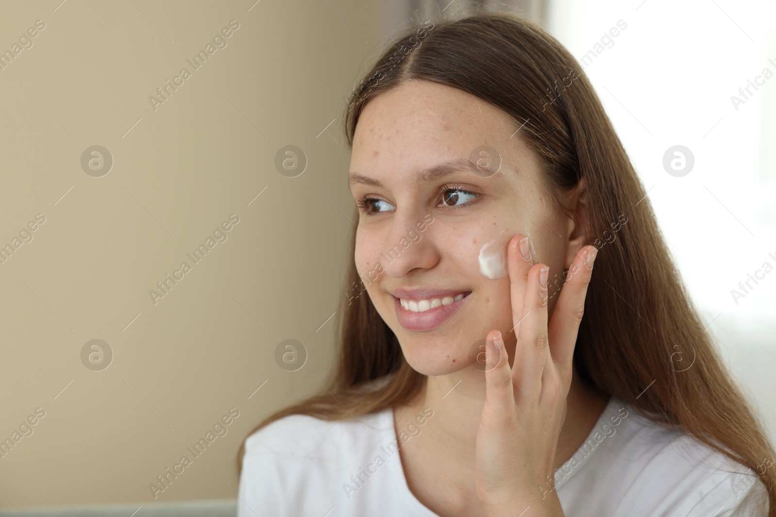 Photo of Teenage girl applying cream onto face at home, space for text. Acne treatment