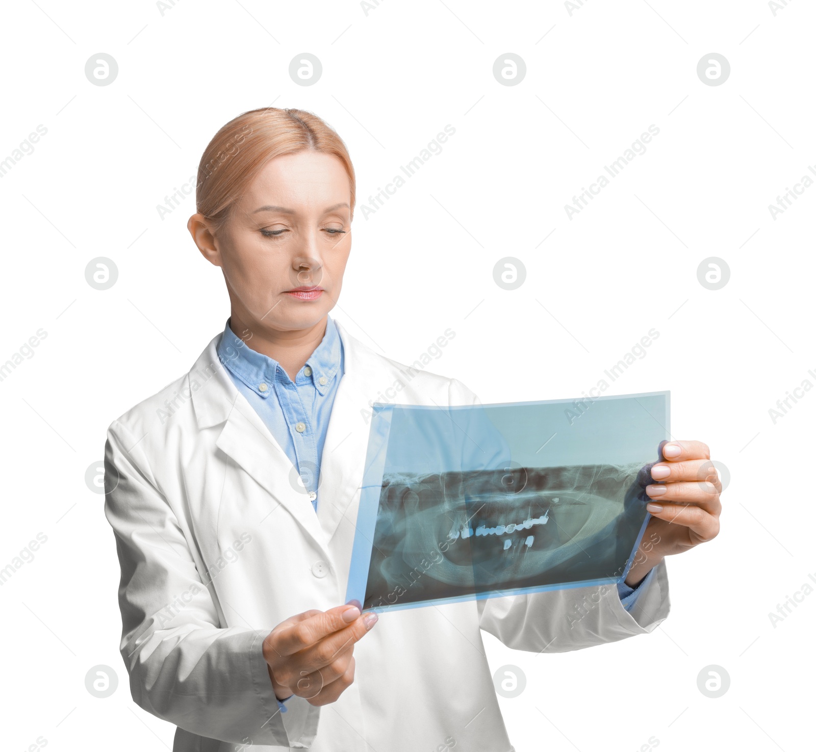 Photo of Doctor examining x-ray image on white background