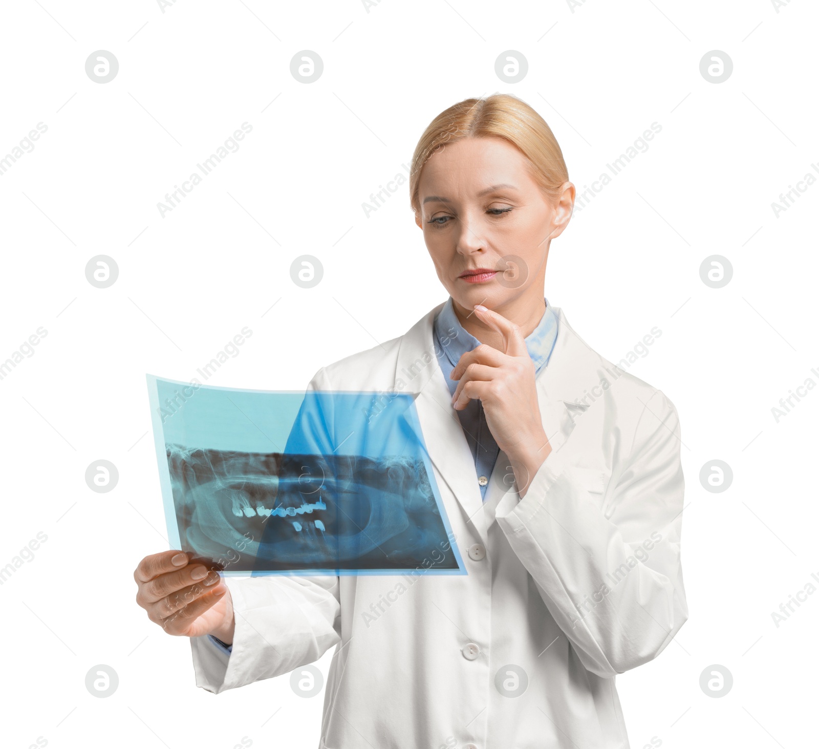 Photo of Doctor examining x-ray image on white background