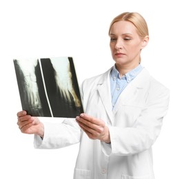 Photo of Doctor examining foot x-ray on white background