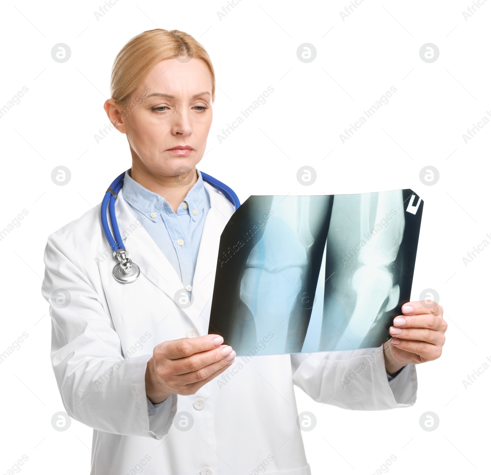 Photo of Doctor examining x-ray image of knee joint on white background