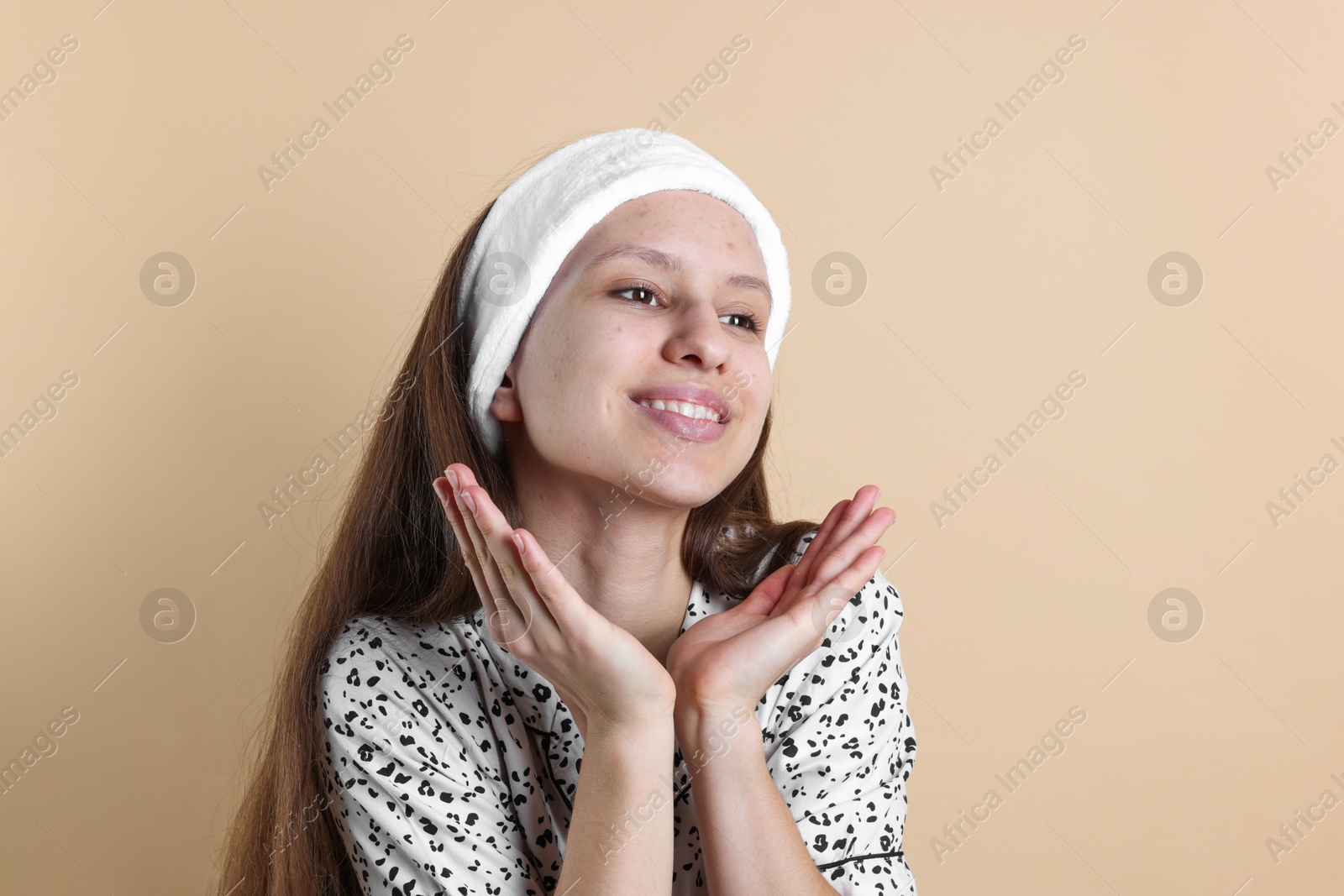 Photo of Teenage girl with acne problem on beige background