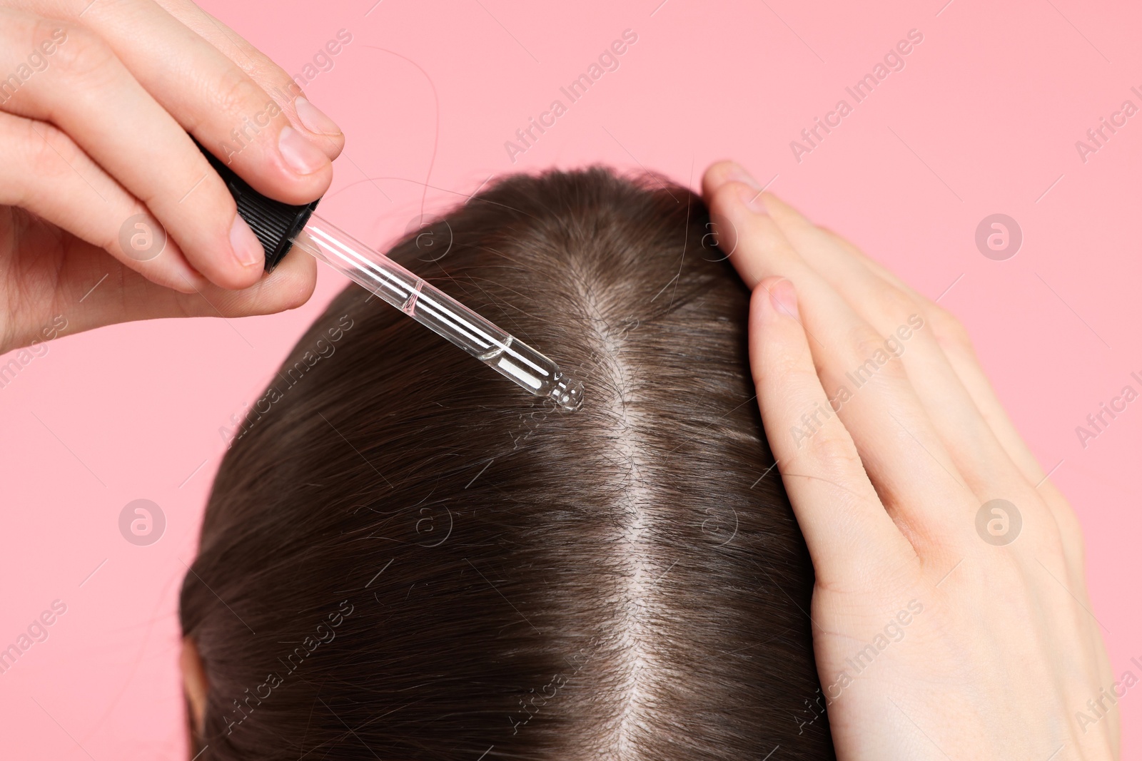 Photo of Hair loss problem. Girl applying serum onto hairline on pink background, closeup