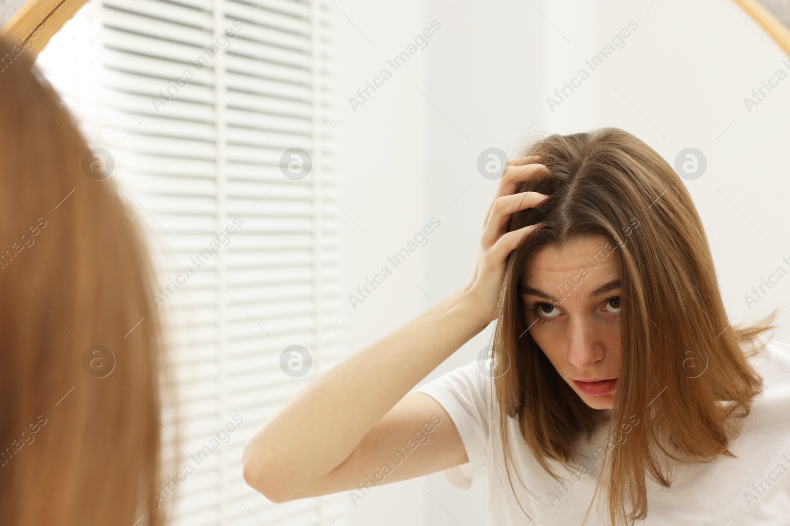 Photo of Girl with hair loss problem near mirror in bathroom