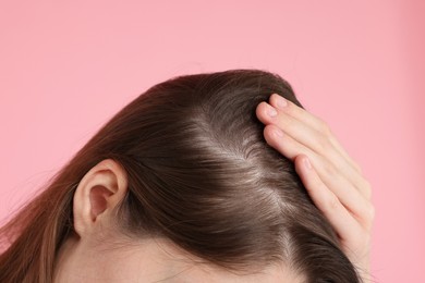 Photo of Girl with hair loss problem on pink background, closeup