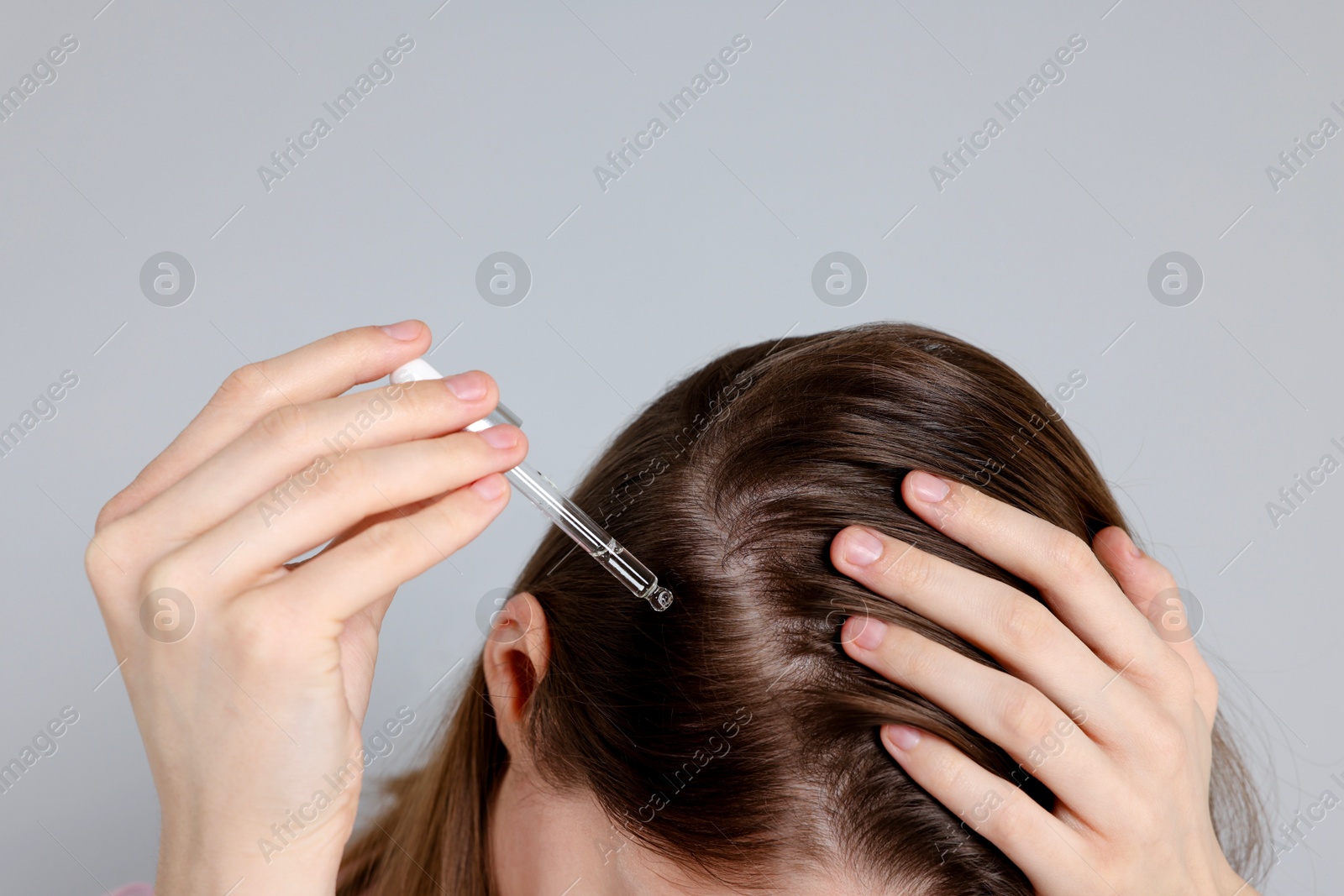 Photo of Hair loss problem. Girl applying serum onto hairline on grey background, closeup