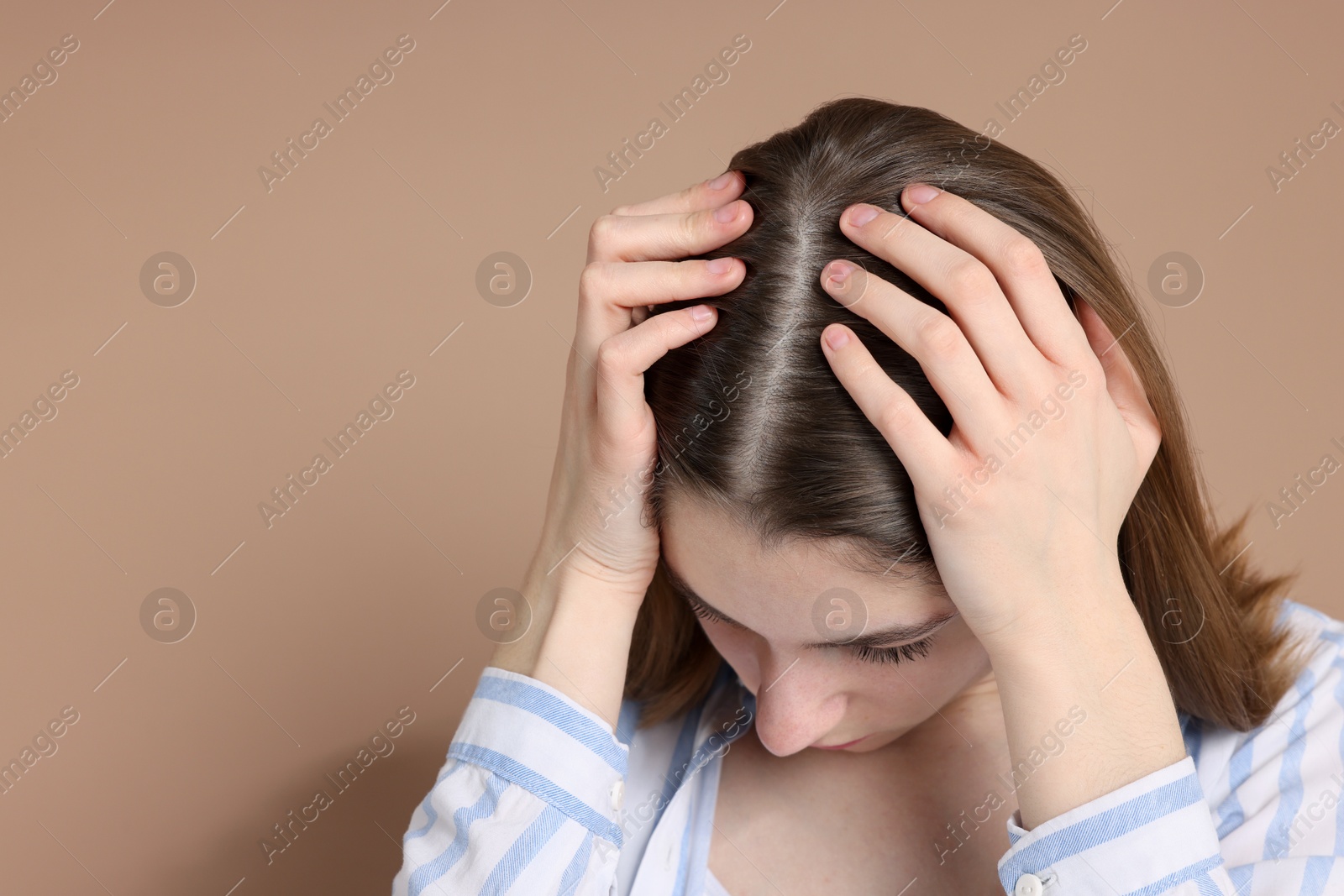 Photo of Girl with hair loss problem on dark beige background, space for text