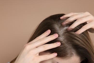 Photo of Girl with hair loss problem on dark beige background, closeup