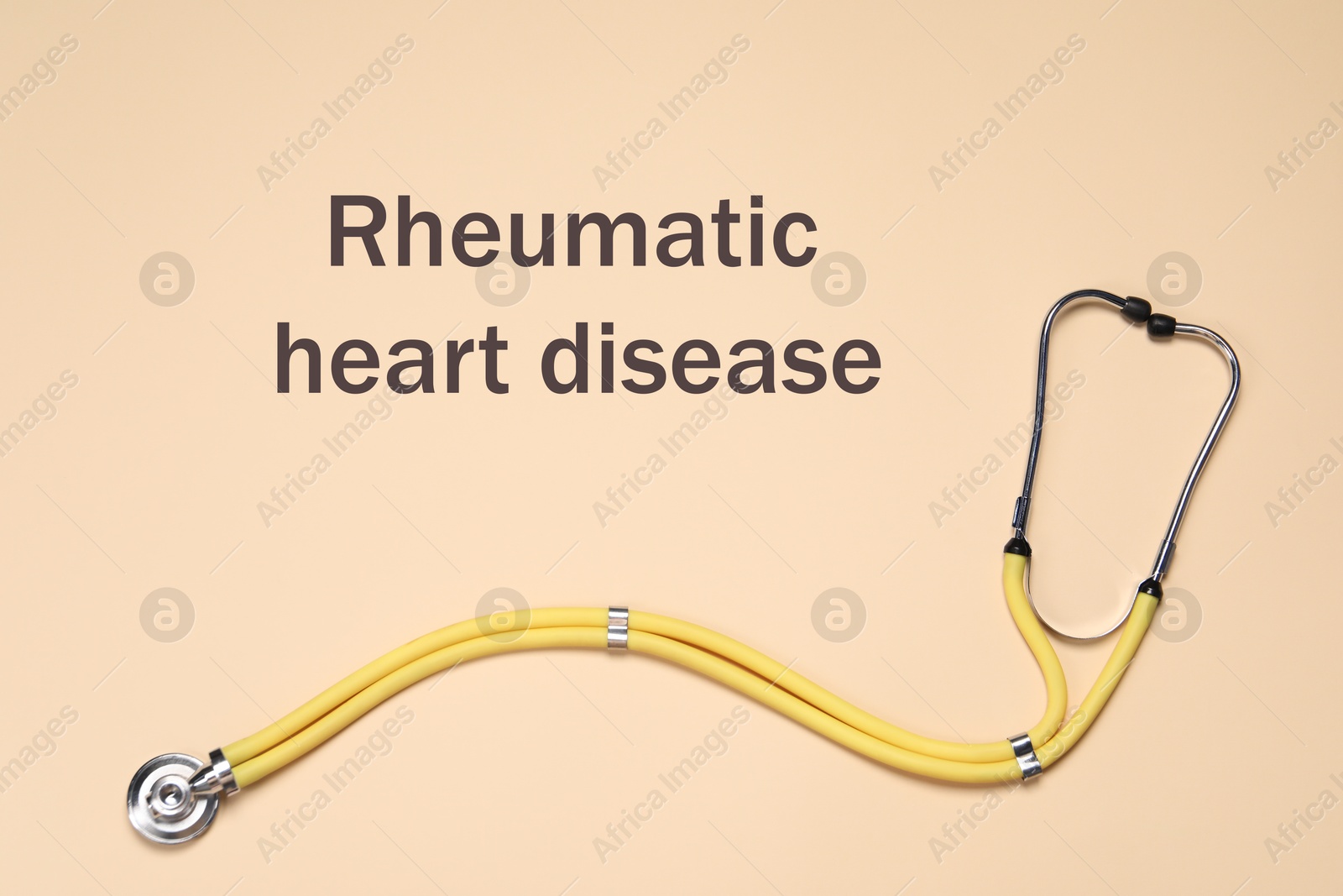 Image of Rheumatism. Stethoscope and words Rheumatic Heart Disease on beige background, top view