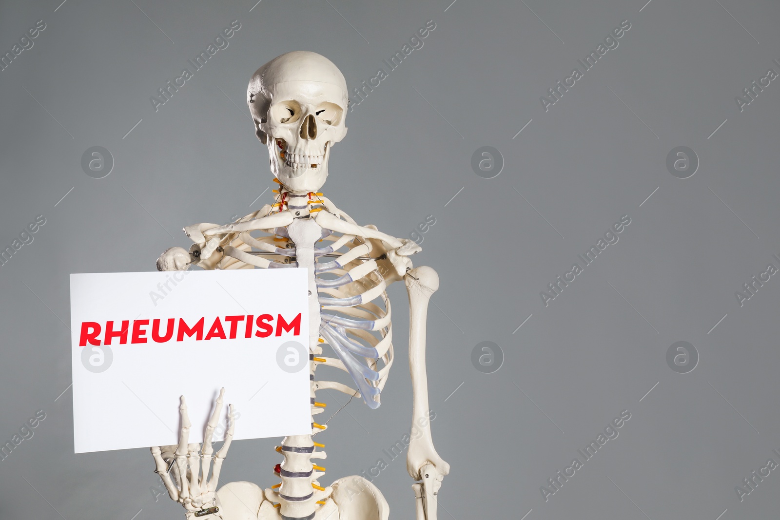 Image of Rheumatism. Artificial human skeleton model holding paper with word on grey background, space for text