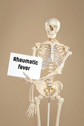 Image of Rheumatism. Artificial human skeleton model holding paper with Rheumatic Fever words on dark beige background